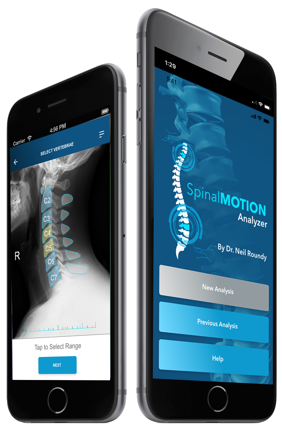 Spinal Motion Analyzer Mobile App